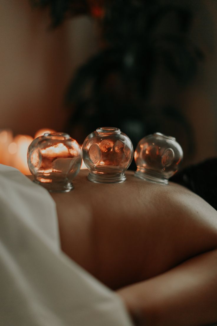 Hijama
