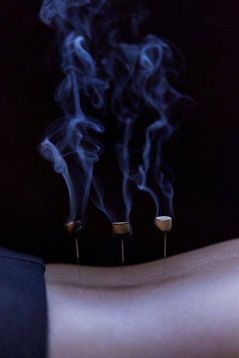 Moxibustion